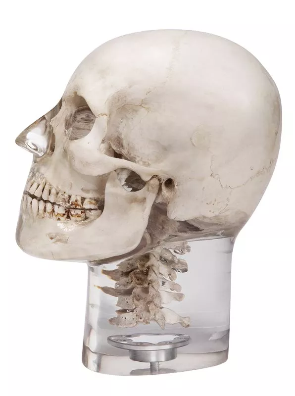 [7300] Röntgenphantom Kopf mit Halswirbeln, transparent