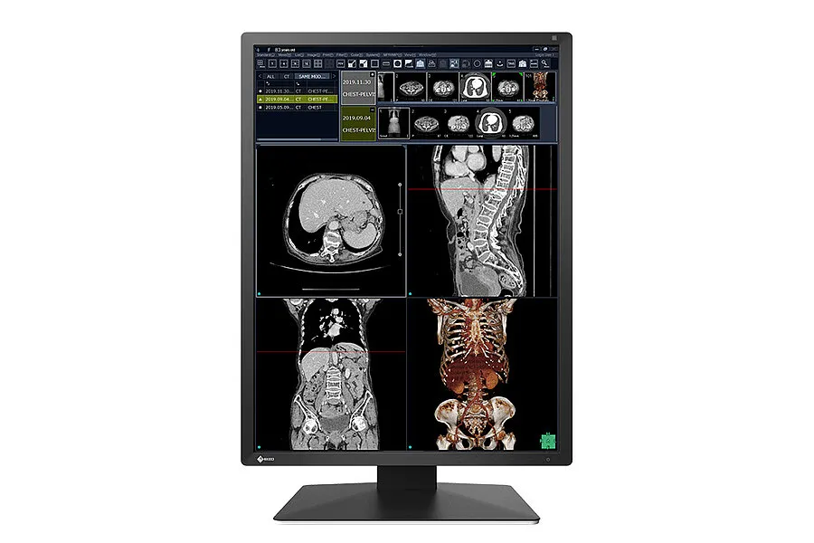 [11000103] EIZO Befundmonitor RX270 RadiForce