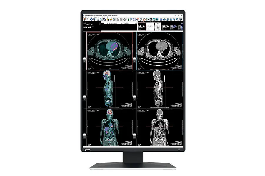 [11000121] EIZO Befundmonitor GX570-(MD) RadiForce