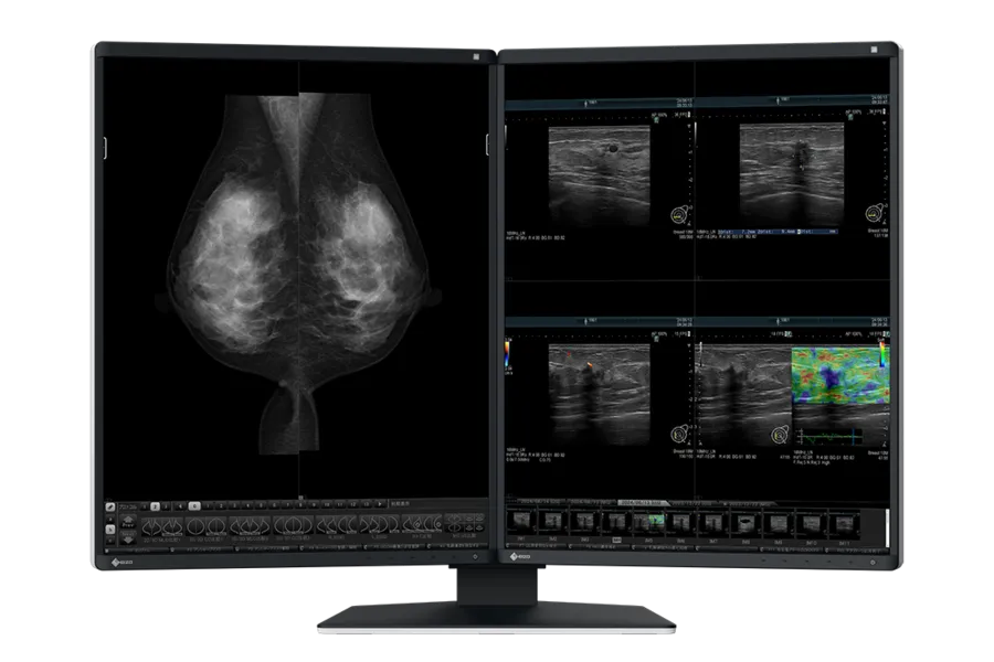 [11000118] EIZO Befundmonitor RX570-(MD) RadiForce