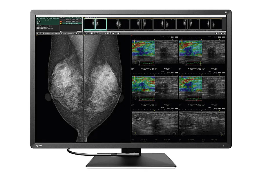 [11000074] EIZO Befundmonitor RX1270 RadiForce